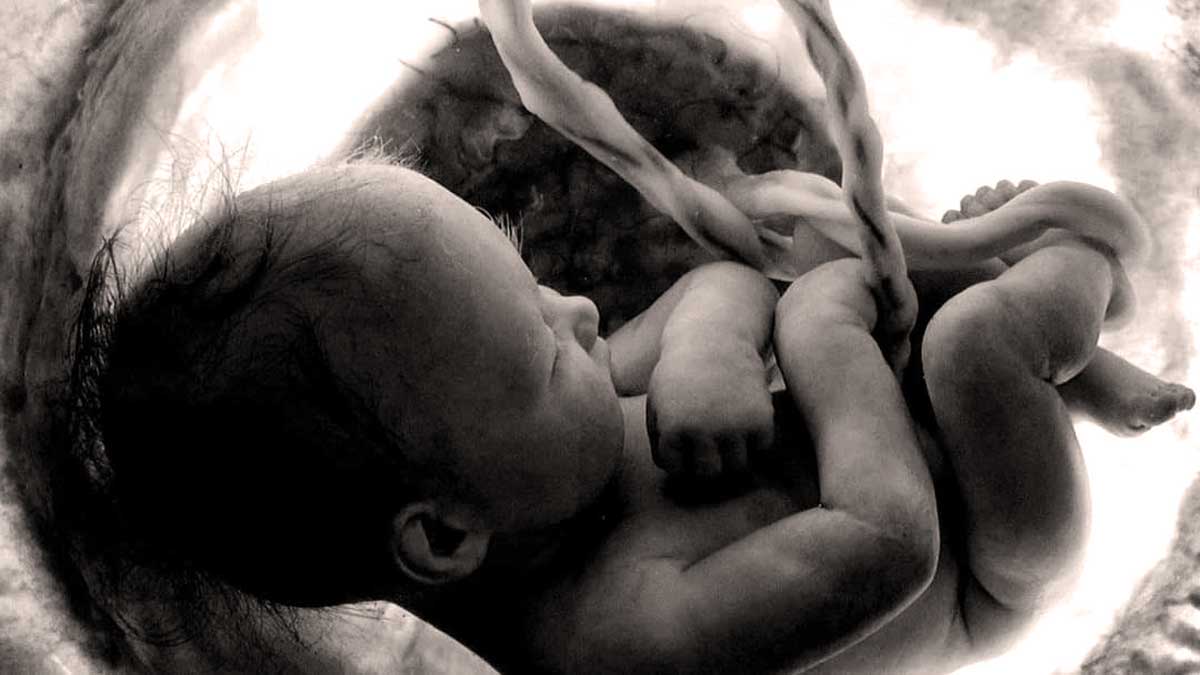 breech birth